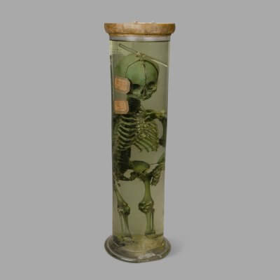 Fetal Skeleton Preserved in Jar , Early XXth